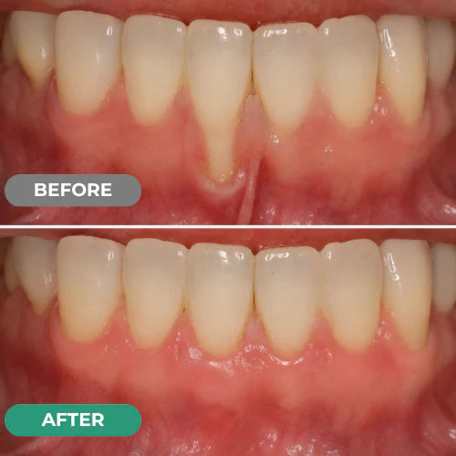 Dr. Lumident Teeth & Gum Repair Gel