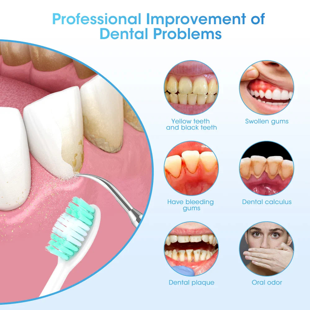 Sparkling Smile Scaler