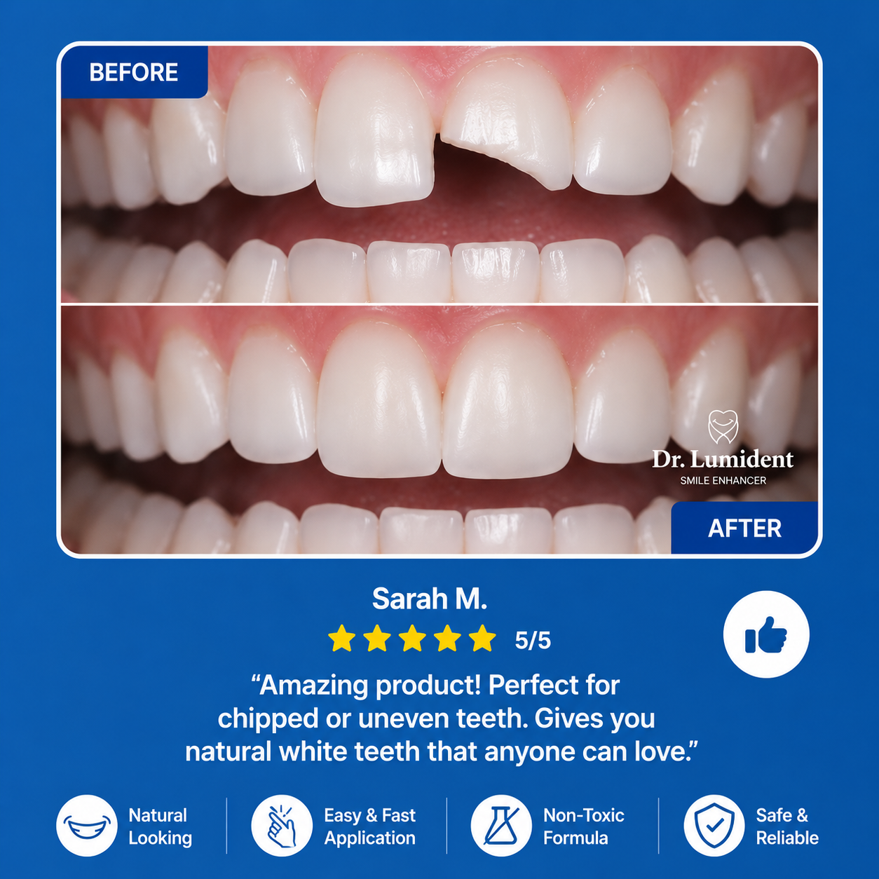 Dr. Lumident Instant Tooth Repair Kit