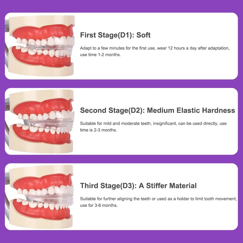 Adult Stage One Teeth Alignment Trainer