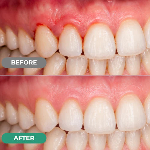 Dr. Lumident Teeth & Gum Repair Gel