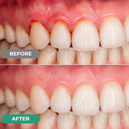 Dr. Lumident Teeth & Gum Repair Gel