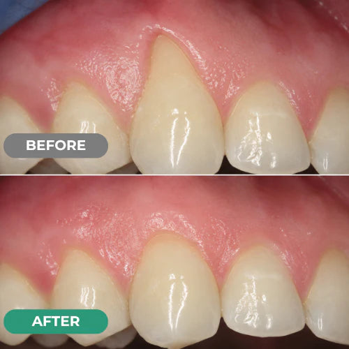Dr. Lumident Teeth & Gum Repair Gel