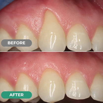 Dr. Lumident Teeth & Gum Repair Gel