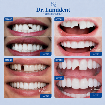 Dr. Lumident Sofort-Zahnreparatur-Set