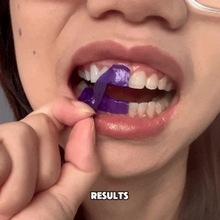Purple Teeth Whitening Strips