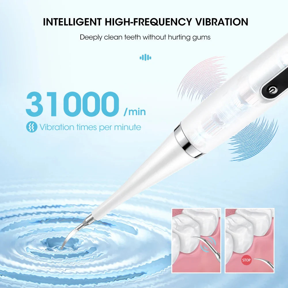 Sparkling Smile Scaler