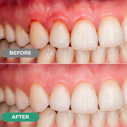 Dr. Lumident Teeth & Gum Repair Gel