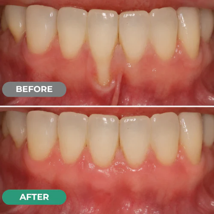 Dr. Lumident Teeth & Gum Repair Gel